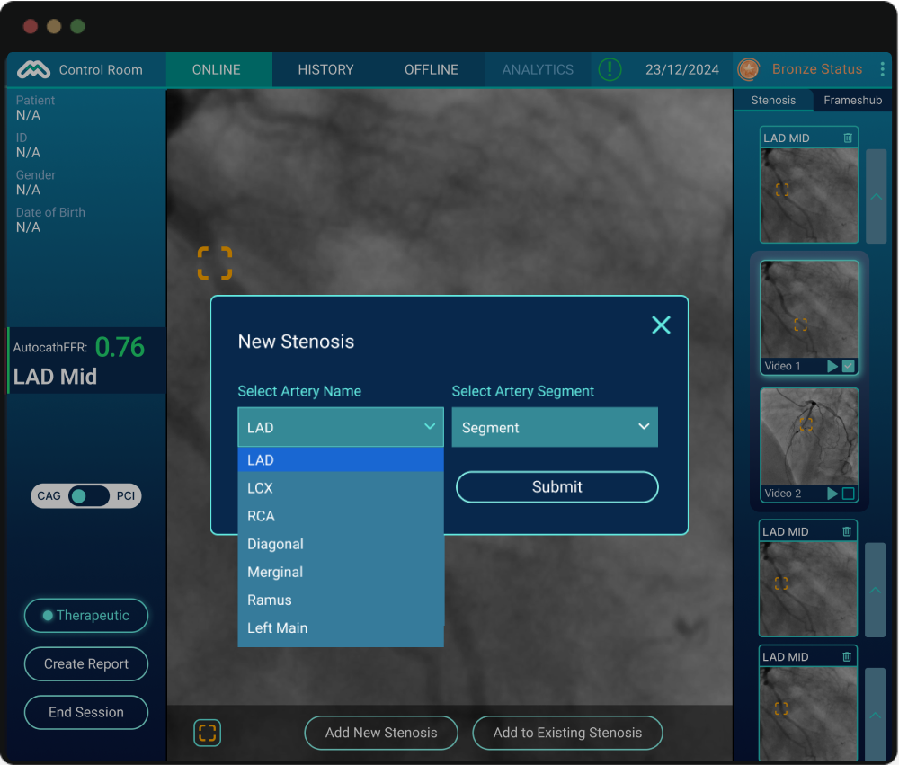 Old UI: no live feedback