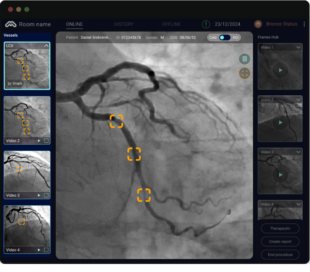 New UI: all stenoses automatically organized