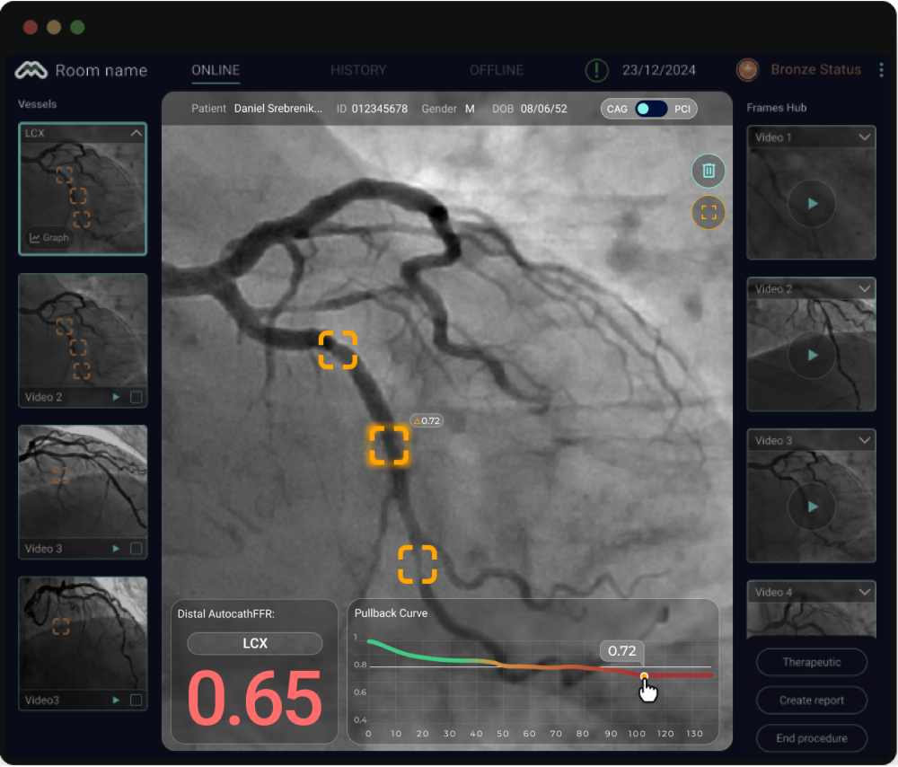 New UI: live graph